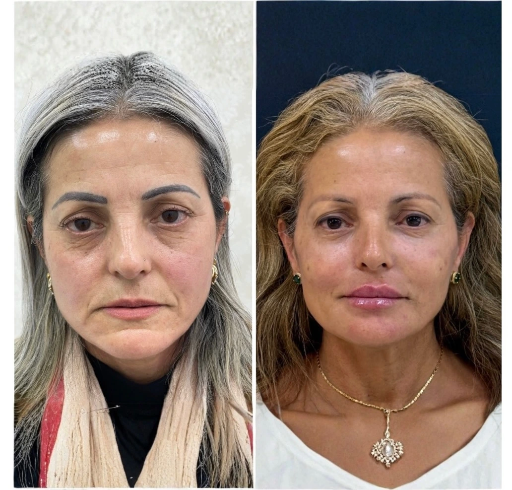 Resultado de tratamento