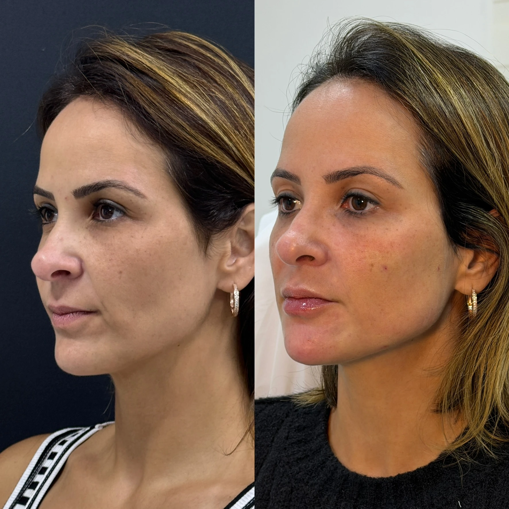 Resultado de tratamento